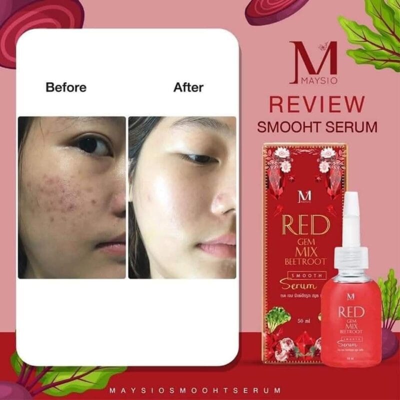 Maysio Red Gem Mix Beetroot Smooth Serum – 50ml | প্রাকৃতিকভাবে ত্বক উজ্জ্বল ও মসৃণ করুন